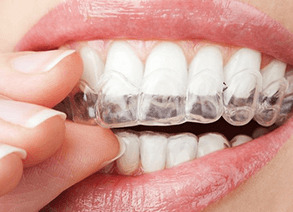 Invisalign trays