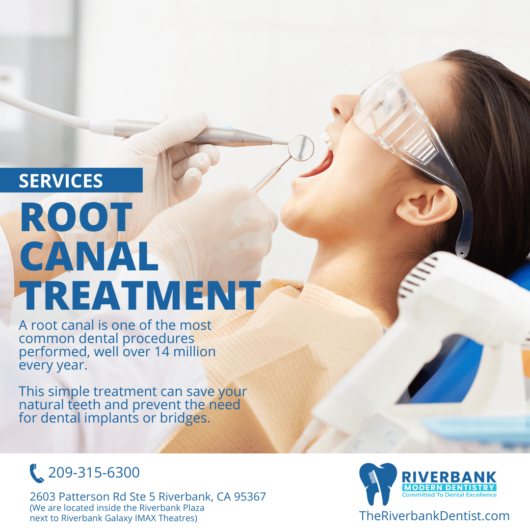 Root Canal Treatment Dentist near me in Riverbank, CA