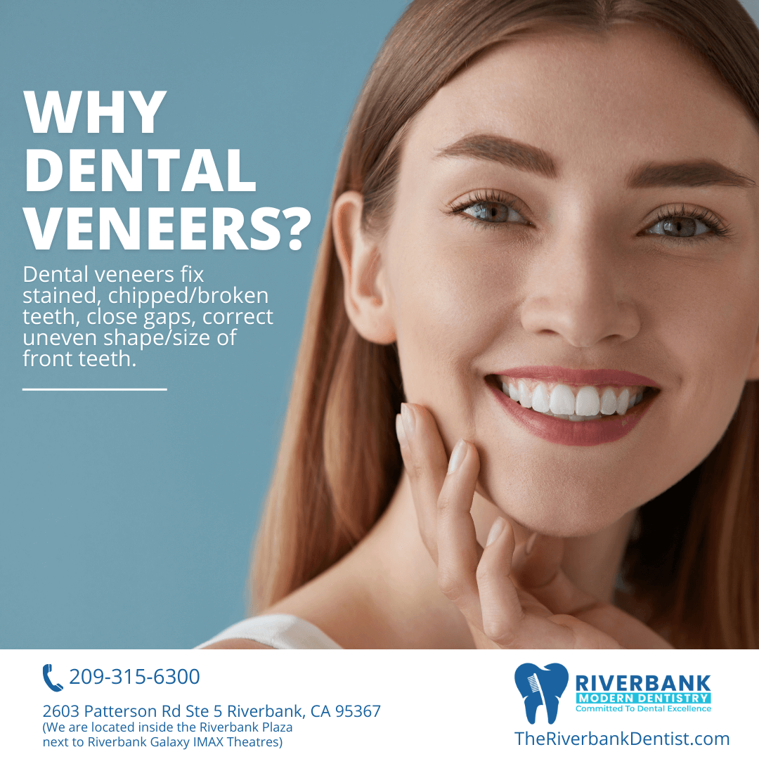 Dental Veneers Dentist near me in Riverbank, CA