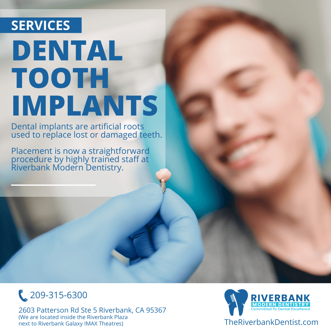 Dental Implants Dentist near me in Riverbank, CA