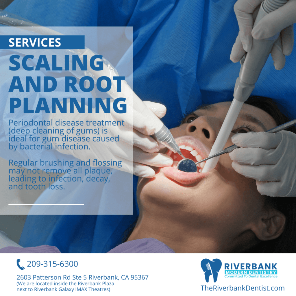 Riverbank Dentist Top Rated Riverbank Modern Dentistry