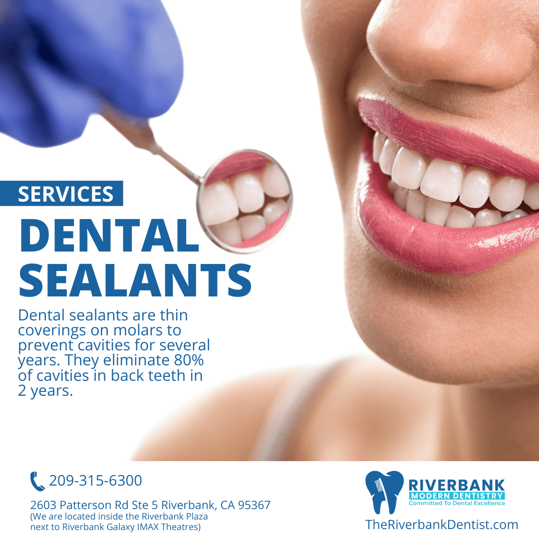 Dental Sealants Dentist near me in Riverbank, CA