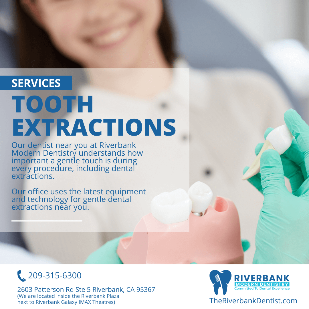 Tooth Extraction Dentist near me in Riverbank, CA